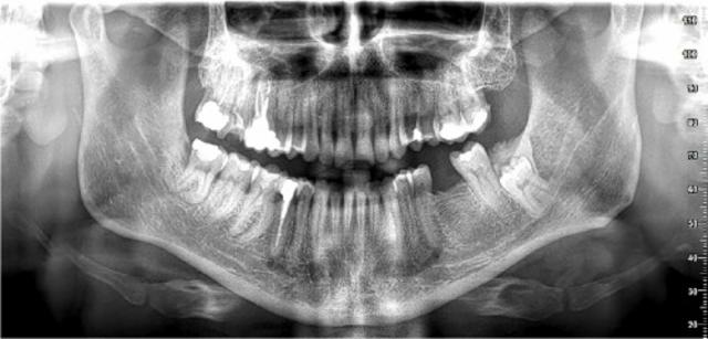 Russian Imperial Stout Barrel Aged Blend 13.5%, Brasserie Popihn, France