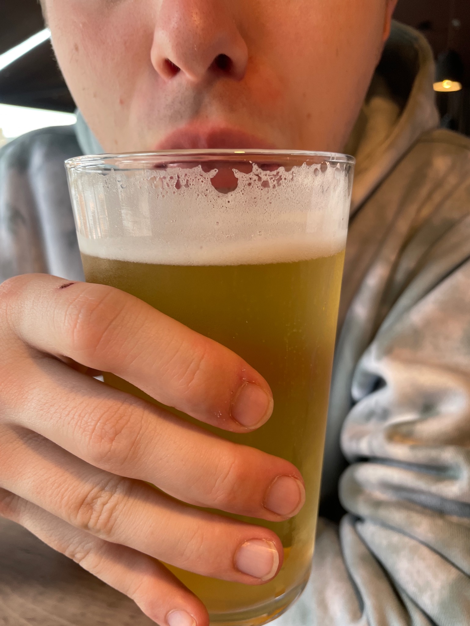 The Cold condition, England